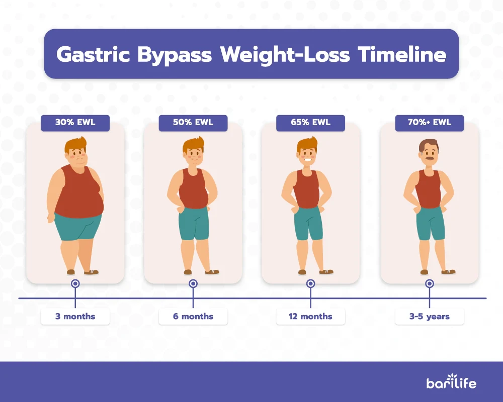 Gastric Band Weight Loss Chart